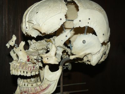 Prezioso preparato storico: cranio umano disarticolato